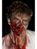 Zombie jaw prosthesis
